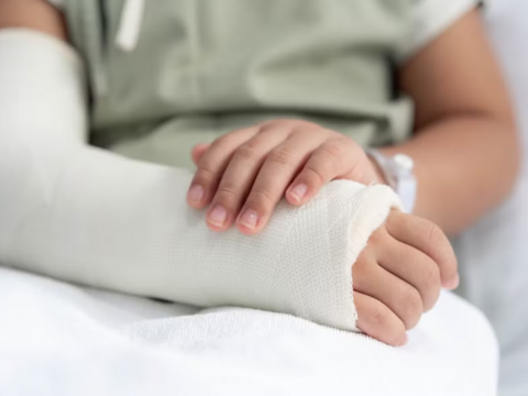 Gãy xương ở trẻ: Hiểm họa rình rập mùa Hè